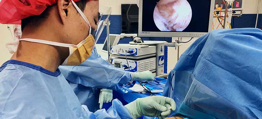 Arthroscopic Rotator Cuff Repair, Orthosports Orthopaedic Surgeons